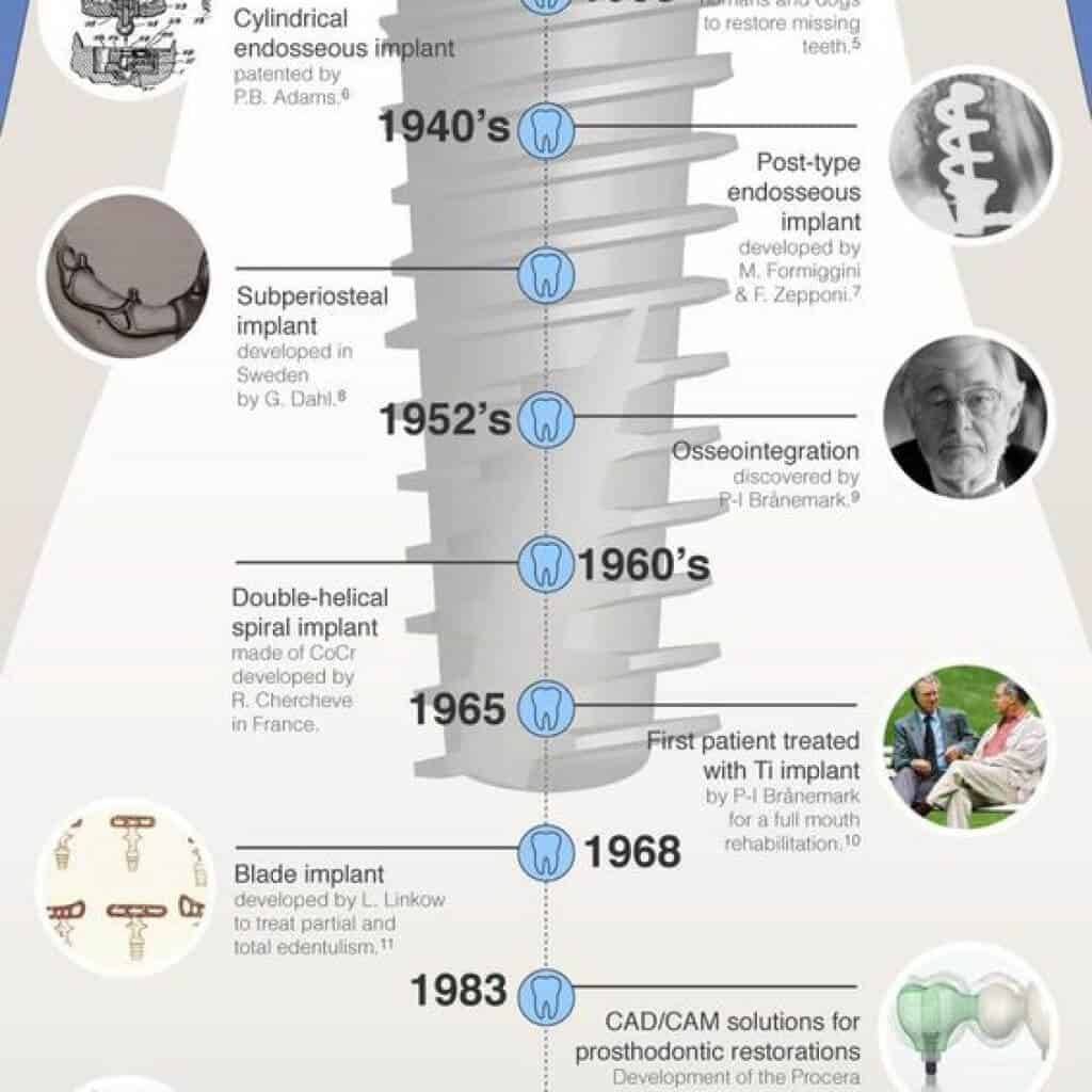 history of dental implants