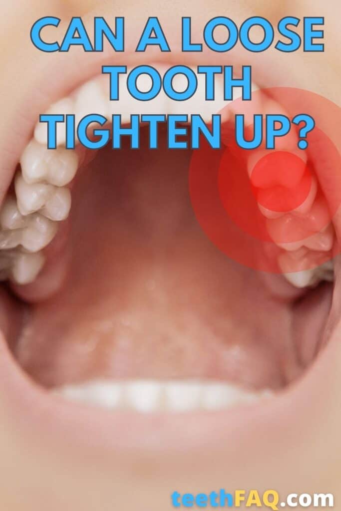 will a loose tooth tighten back up