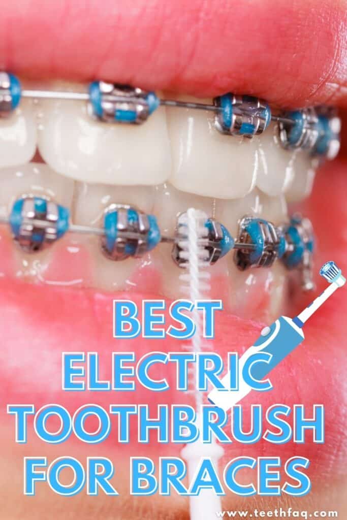 best electric toothbrush for braces