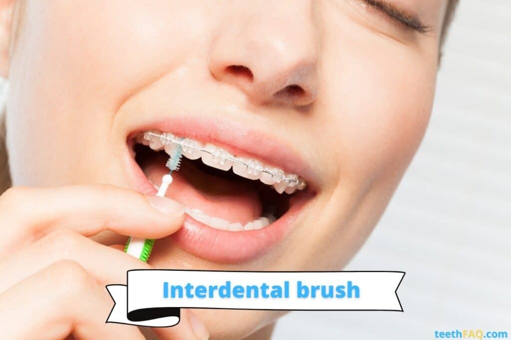 interdental brush for braces